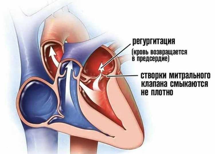 Проблемы системы смазки и их последствия